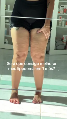 Um mês e alguns dias que comecei o tratamento do meu lipedema, menos dor, inchaço e mais autoestima🥹🙏🏻 Lembrando que já comia do meu “jeito saudável” há um bom tempo e fazia exercícios, mas o que realmente deu resultado foi alimentação específica+drenagem✨ Obrigada @@Mayary Rocha@danielecardozo12 por me apoiarem nesse jornada💐🤍