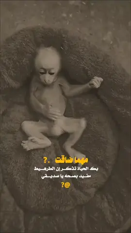 مهما ضاقت بك الحياه تذكر ان الترهيط مفيد ب الصحه #قصف_جبهات😎🚬 #عبارات_جميلة_وقويه😉🖤 