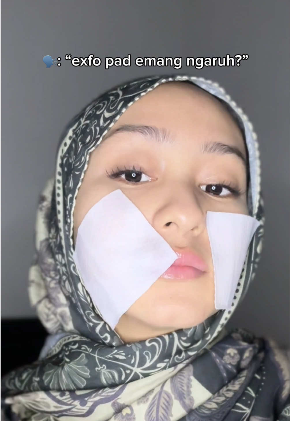 kulit auto mulus no gradakan!!🫶🏻 #exfopads 