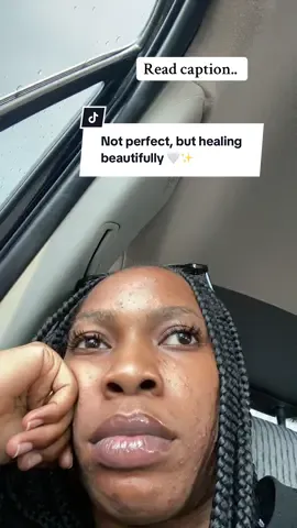 It all started when a skincare vendor who claimed to be an aesthetician recommended a bunch of products with heavy actives for me to use every day. I knew nothing about skincare at the time, so I followed every instruction exactly as told, hoping for clear glowing skin. But instead, my skin broke out so badly, painful acne, irritation, and scars I couldn’t hide. I remember crying so many nights, not recognizing myself in the mirror anymore. It really took a toll on my confidence. Fast forward to now, it’s not perfect, still a work in progress. But my skin finally feels like me again. There are still scars, dark spots, and random breakouts, but there’s also progress, peace, and acceptance. I’m just grateful for how far I’ve come 🤍✨ #skintransformation #skinjourney #tretinoin #aesthetician 