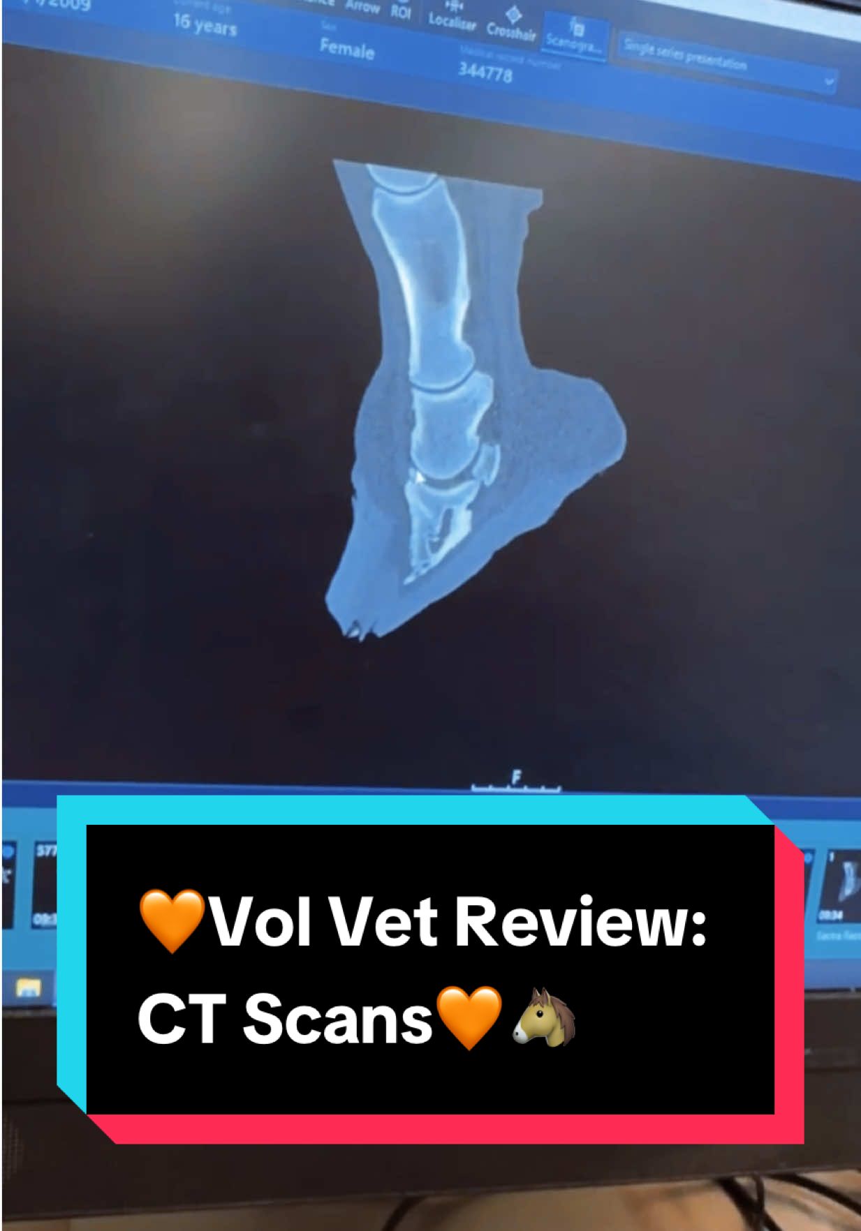 🧡Vol Vet Review: CT Scans🧡🐴 #equinevet #equineveterinarian #equinecare #horsecare 