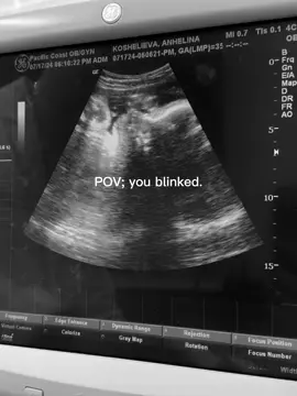 #baby #moms #momscreator #creator 