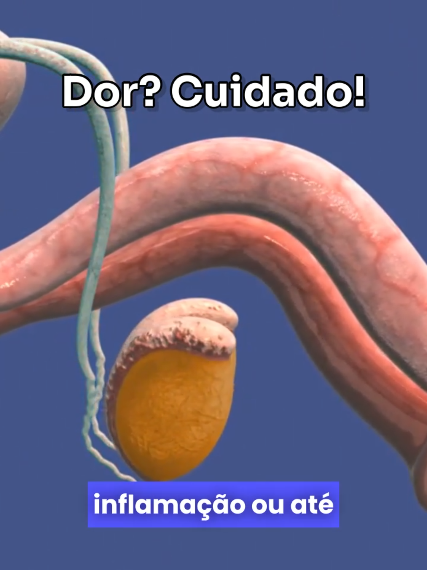 Ejaculação dolorosa? Isso nunca é normal. 🩺 Faça um check-up e evite complicações. 👉 Compartilhe com quem precisa saber disso! 🔗 Para saber mais e agendar sua avaliação: Site: www.marciodantas.med.br Whatsapp: 11985926308 #SaúdeDoHomem #Urologia #VidaSaudável #saudohomem #saudemasculina #saúdemasculina #Prevenção #dor #dorgenital #dolorida #dolorido #sentirdor #dúvidas #dúvidamasculina #duvidamasculina