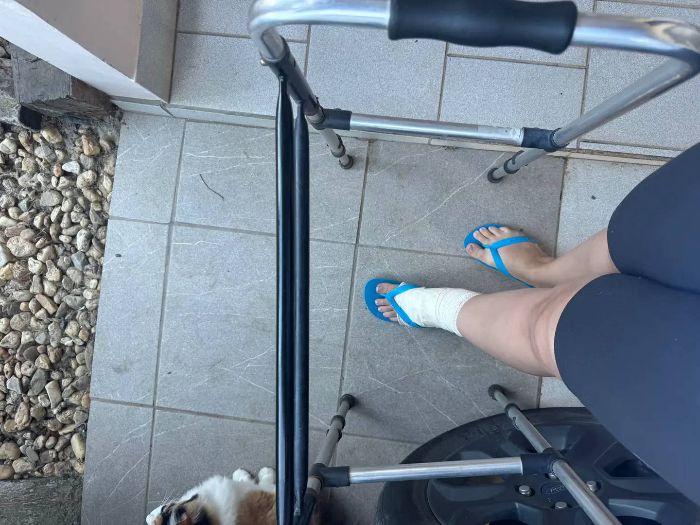 Tirei meus parafusos kkkkk ando bem cansada mas faz parte xD bastante medicação e dor, e logo fisioterapia! #cirurgia #acidente 