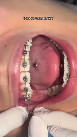 Bora de manutenção? #cordeborrachinha #aparelhoortodontico #aparelhofixo #piercingnalingua 