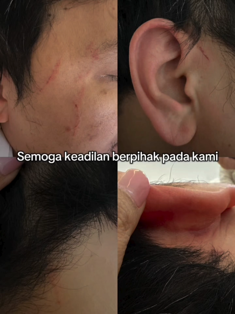 Membalas @asmaputriloka Kronologi Lengkap dugaan Penyerangan yang berujung penganiayaan suami dan karyawan Dokter oleh Oknum Kepala Desa atau Kuwu Anjatan bersama beberapa Oknum Masyarakat Desa Anjatan Indramayu #indramayu #indramayuviral #indramayupride🏴‍☠️ #kuwuanjatan #bupatiindramayu 