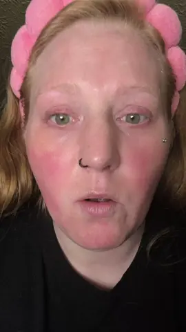 yeah this definitely eats down I highly suggest getting it so much cheaper than having to go to the dermatologist and do it cuz it's just as good and it's half the price @Fyne Skincare #fyneresults #fyneskin #microinfusion #tiktokshopcreatorpicks #skincaretips 