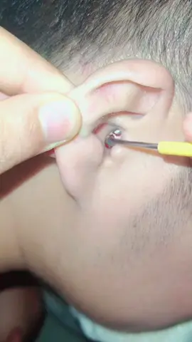 part 1...#1millionaudition #viraltiktok @LosAngeles-Ticks-2 