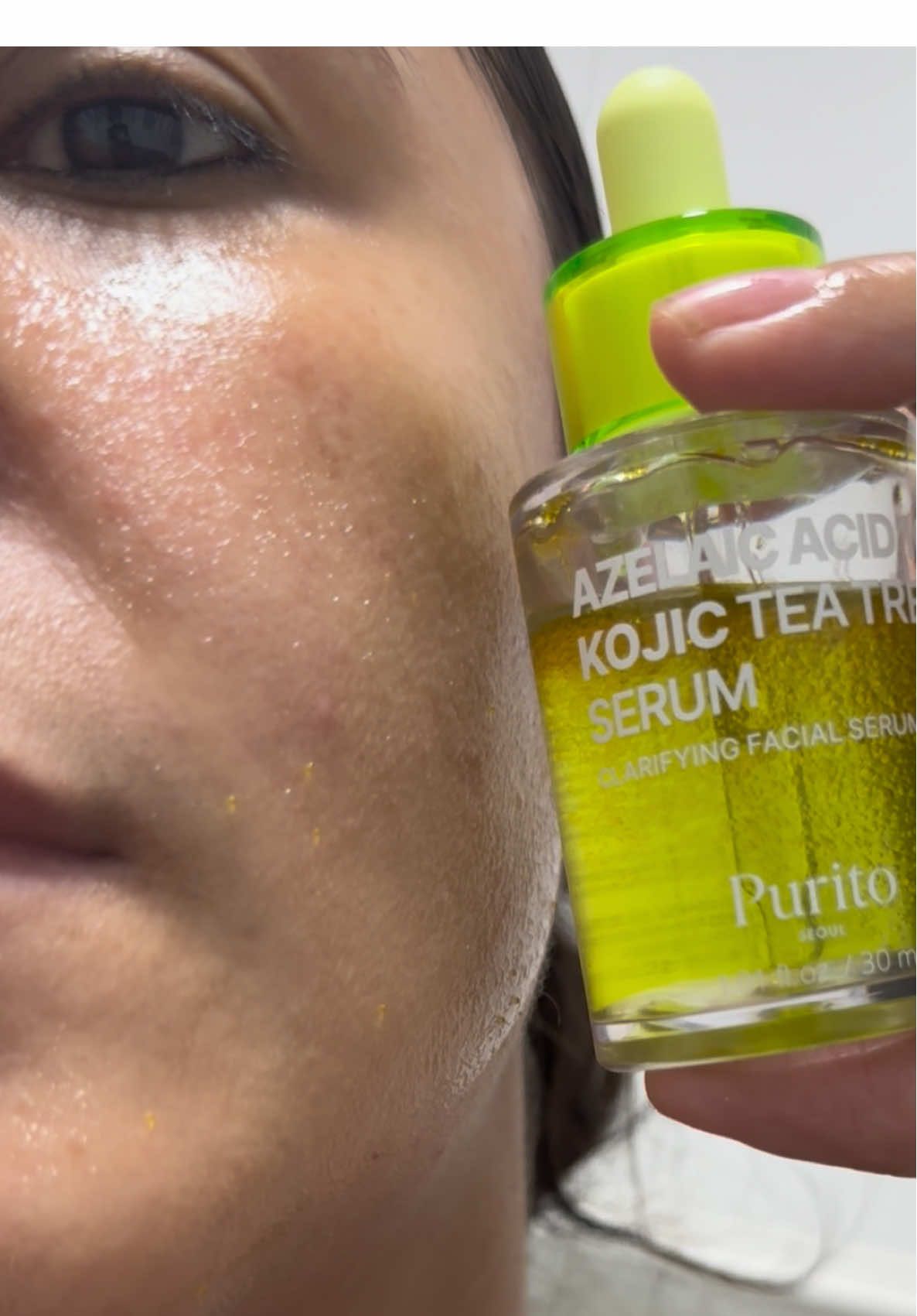 This  Azelaic Acid 10 Kojic Tea Tree Serum of @PURITO SEOUL It should not be missing in your acne routine, thanks to its ingredients it will help you improve your skin. #creatorsearchinsights #purito #acne #azelaicacid #koreanskincare 