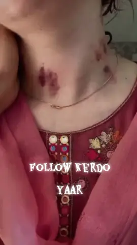 very romantic video for you🫣🥰💋💋#loveyou #trend #kiss 