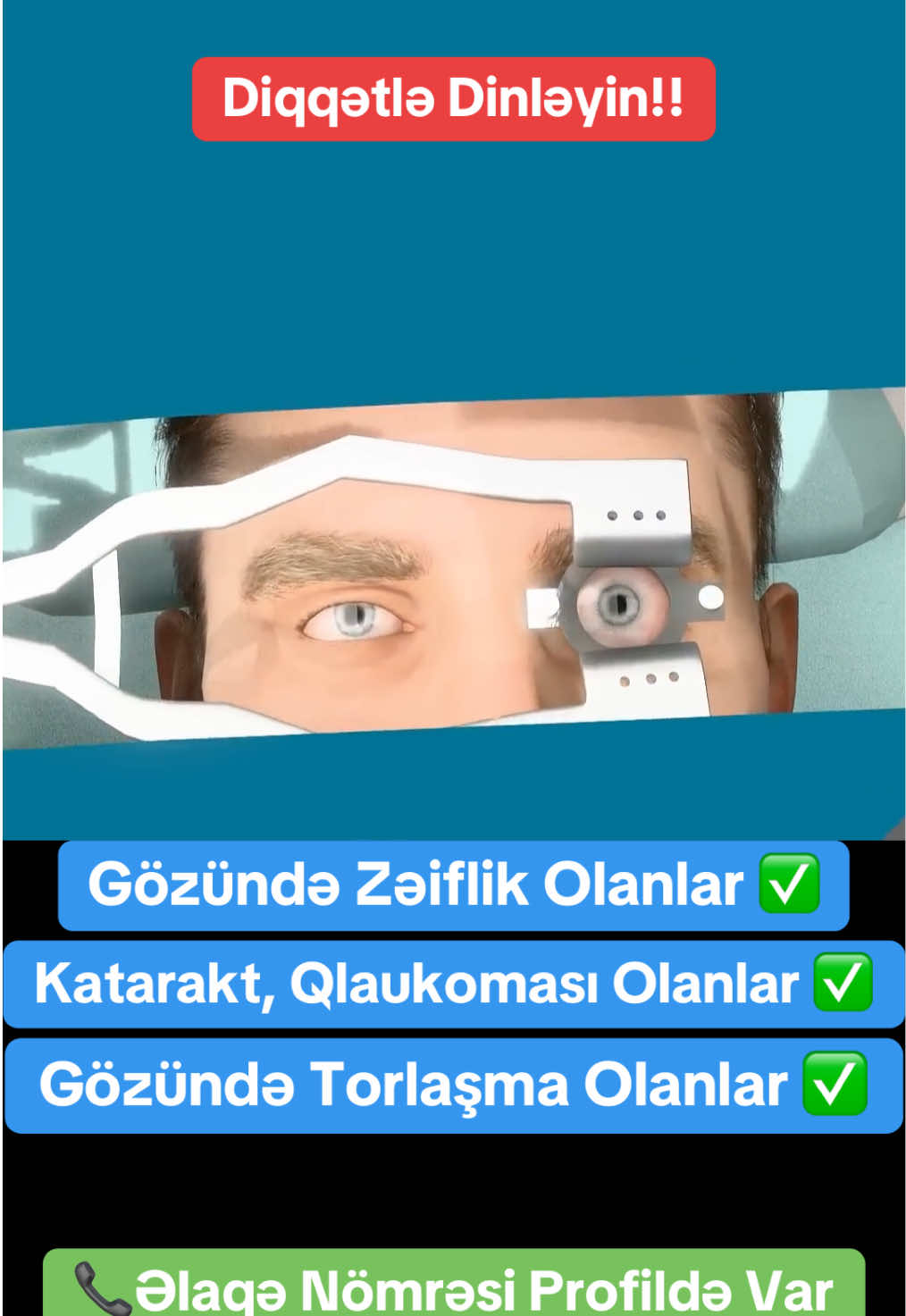 #göz11keşfet #mirvarisuyu #katarakt #qlaukoma #torlaşma 