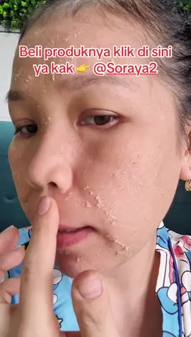 BELI PRODUK DAN KERANJANG KUNINGNYA KLIK DI SINI YA 👉 @Soraya2 