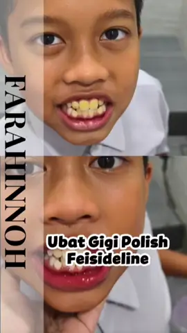 Replying to @alang79_fiona Yee sis ..tq taww bg feedback.. kalau kids lg cepat effect dia.. sbb karang gigi, atau kotor kt gigi masih lembut.. untuk org dewasa konsisten 2kali sehari taw. #feisideline #polish #ubatgigipolish #farahinnoh #seaideal 