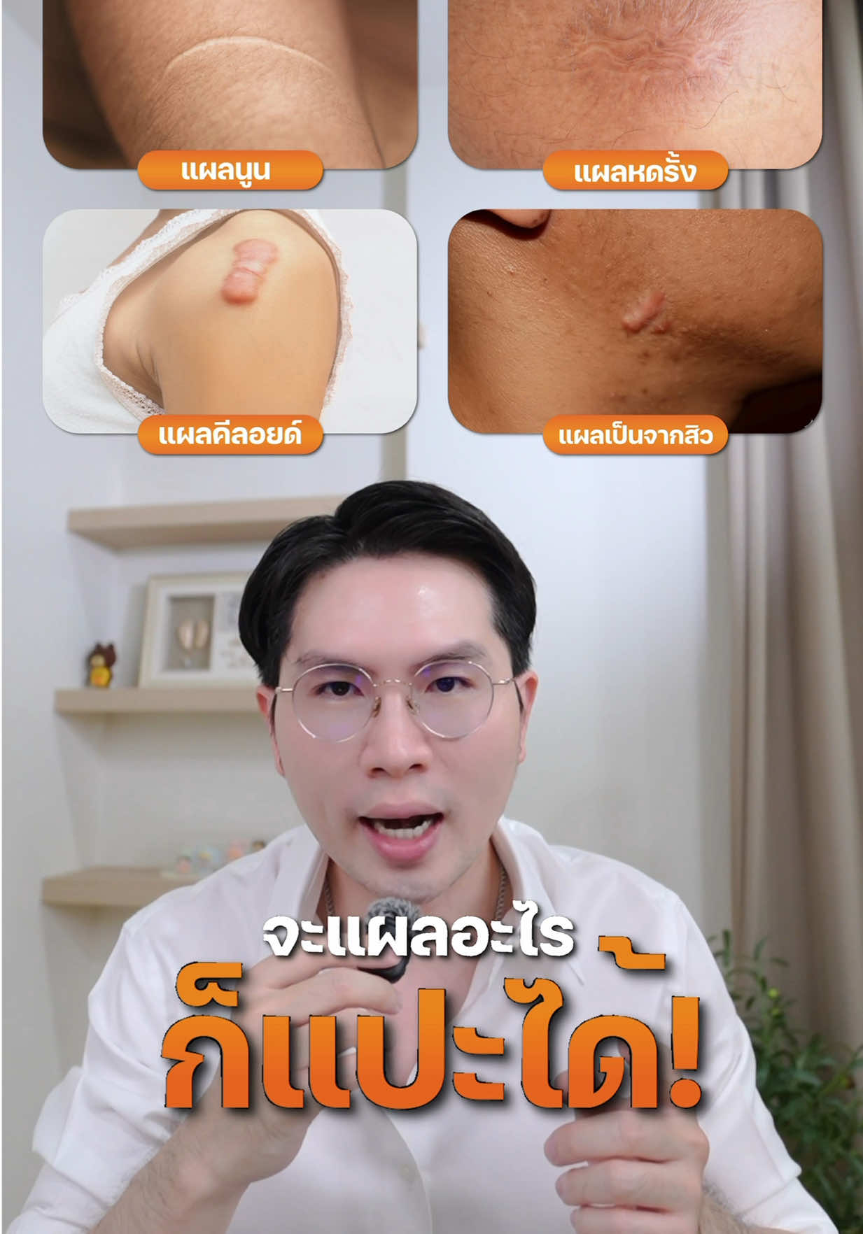 ใครมีแผลเป็น ติดง่ายสะดวกมาก @Be Better #แผลเป็น #แผลเป็นนูน #แผลคีลอยด์ #แผลผ่าตัด #แผ่นซิลิโคนลดรอยแผลเป็น 