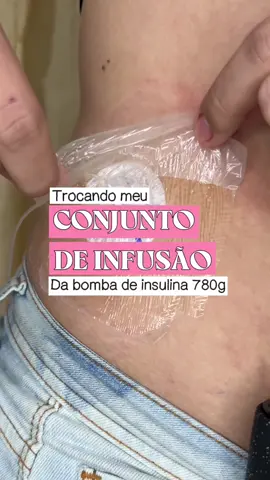 A cada 3 dias pela vida toda 🩵🫡 #diabetestipo1 #diabetestype1 #foryoupage #diabetes #insulinpump 