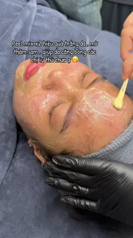 Peel trắng da căng bóng, mờ thâm siêu VIP ✨ Peel mix x2 hiệu quả – da bong mảng nào là sáng mịn mảng đó 😍 Ai thử rồi là mê luôn đó ạ 💕 #thuykieubeauty8 #spabacninh #xuhuong #lamdep #trangda 