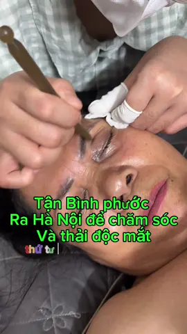 Buổi 4 chô cô gái xinh đẹp tới từ Bình Phước #ngứamắt #thảiđộcmắt #mờmat #chămsócmắt #mắtyếu 