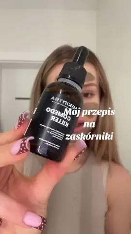 Sprawdzony sposób, który zawsze uratuje Was przed tymi brzydkimi kropkami na nosie w jednym filmie 🙏🏻 Kwas salicylowy+ glinka zielona U mnie marka SkinTra od @Cosibella i Glinka zielona Nacomi [współpraca afilacyjna]  #skincare #kwassalicylowy #cosibellaafiliacja #acneskin 
