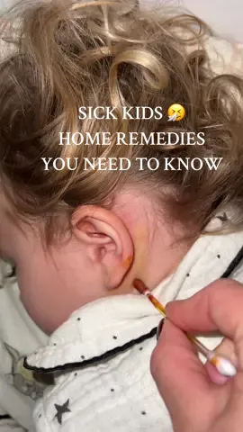 Sick Children - Home Remedies I Use to Comfort My Daughter #sickkids #homeremedy #sickbaby #coldremedies #momtok natural way to heal/ comfort your sick baby if you don’t want to use medicine  What exactly is pear compote good for? For the respiratory tract: Moisturise the throat and mucous membranes. Helps remove excess mucus from the lungs and respiratory tract. Relieves dry coughs, scratchy throats, and hoarseness. Supports the body in fighting colds and flu. For immunity: Add cinnamon, cloves or honey (if you are not allergic to it), which have antioxidant and antibacterial properties. Supports digestion and intestinal peristalsis thanks to its fiber content. Prevents constipation. Quince has numerous health benefits, including boosting immunity and helping with colds due to its high vitamin C and antioxidant content. It also supports the circulatory system, lowering blood pressure and improving cholesterol levels. Quinces should be harvested in October or November, when they turn from light yellow to gold and are incredibly aromatic. They don't usually fully ripen in the UK summer, but should be left on the tree as long as possible to enhance their flavour, then harvested before the first frost.