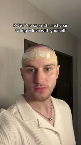 Best decision ever #hair #hairtransformation #hairgrowth #hairtransplant #GlowUp