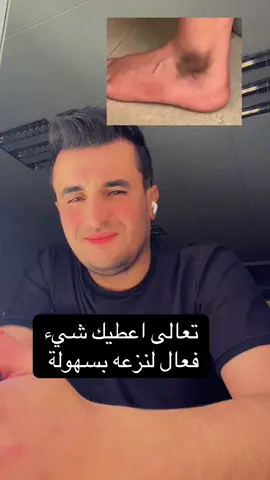 ☕ القهوة: تُستخدم عادة كمقشّر طبيعي للبشرة أو لتحفيز فروة الرأس. 	•	🧂 بيكربونات الصوديوم: مادة قلوية قوية، قد تسبّب تهيّجًا للجلد أو فروة الرأس إذا استُعملت بكثرة. 	•	🧴 الشامبو: منظّف للشعر، يمكن خلطه ببعض المواد الطبيعية ولكن بحذر. 	•	🍯 العسل: مرطّب ومغذٍّ طبيعي ممتاز. 	•	🍋 الليمون: يحتوي على أحماض قد تُفتح البشرة أو الشعر، لكنه قد يسبب تحسّسًا عند التعرض للشمس. ⚠️ تحذير: خلط الليمون وبيكربونات الصوديوم والشامبو معًا يمكن أن يسبّب تهيّجًا قويًا للجلد أو تلفًا للشعر، لأن المزيج يكون شديد الحموضة أو القلوية #الاكسبلور #يارب_دعوتك_فأستجب_لي_دعائي #تلاوة_خاشعة 