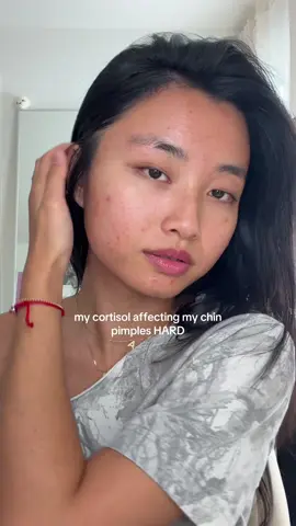 day 2 of getting rid of my chin pimples before halloween☹️ #acne #pimples #acneproneskin #acnejourney  @BIODERMA USA micellar water  @medicube global @medicube_us booster pro  @MEDIHEAL pdrn pads  @iUNIK @IUNIK US beta glucan power serum  @anua_global azeliac acid serum 