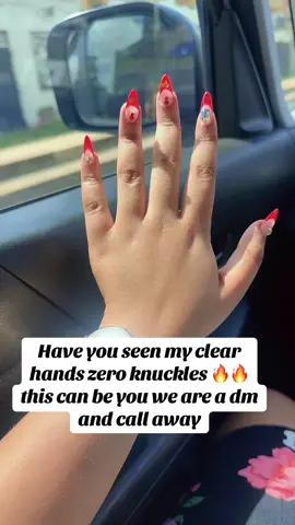 #tiktokenya🇰🇪 #tiktoknairobi🇰🇪 #tiktokuganda🇺🇬🇺🇬🇺🇬 #tiktokusa🇺🇸 #caretoneskincarekenya 