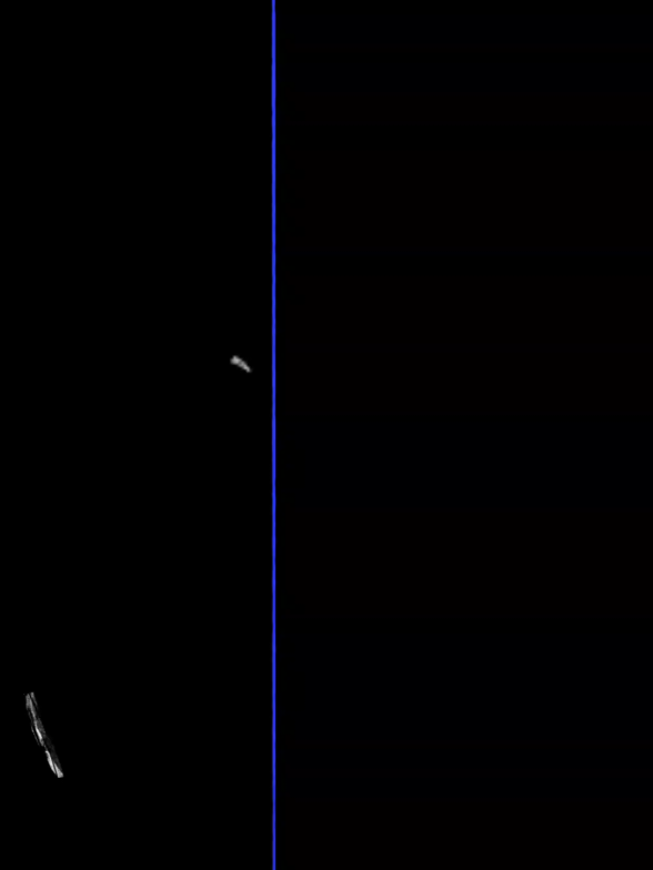 موضوع اني ارجع سليم وانسي تفكيري ف القديم 😮‍💨🤷🏽 . . . #عصام_صاصا #حالات_واتس #عصام_صاصا_الكروان #foryou             #creatorsearchinsights 