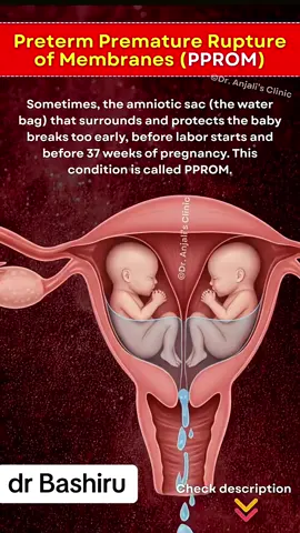 #ivf #fyp #ttc #infertility #baby 