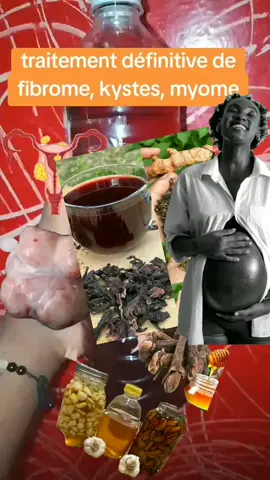 Tomber enceinte  rapidement  avec notre kits de fertilité, aloe vera et fertilité, astuce pour savoir si on attend des jumeaux, astuce pour tomber enceinte rapidement islam, astuce pour tomber enceinte rapidement jumeaux, c'est quoi une personne stéril, comment être enceinte le plus vite possible, comment eviter la sterilite, comment garder le sperm pour tomber enceinte rapidement, comment guérir, comment guérir infertilité, comment lutter contre la sterilite, comment savoir si on attend des jumeaux avant lechographie, Comment traiter la stérilité, comment traiter ou guérir la stérilité, comment vite tomber grossesse, conseils gyneco pour tomber enceinte, définition de la stérilité, douleurs debut de grossesse jumeaux, douleurs debut de grossesse jumeaux forum, est ce que la stérilité se soigne, feuille de laurier et clou de girofle pour tomber enceinte, forum position pour ne pas tomber enceinte, gingembre pour tomber enceinte forum, guérisseur africain, les symptôme de la sterilite chez la femme, les symptômes de la sterilite chez la femme, MAITRE PUISSANT, marabout africain, marabout compétent, marabout du monde, marabout honnete, marabout inde, marabout serieux, médecine traditionnelle, methode pour tomber enceinte forum, petit cola pour tomber enceinte, pharmacopée, pourquoi la stérilité, puissant guérisseur, quelle recette utiliser pour faire d'enfant facilement, quelles sont les causes de la sterilite, quels sont les signes de sterilité, recette africaine pour tomber enceinte, recette de grand mère pour tomber enceinte de jumeaux, Recette pour vite tomber enceinte, remède grand mère pour ne pas tomber enceinte, remède miracle, remede naturel pour augmenter l'ovulation, signes nidation jumeaux, symptomes grossesse jumeaux forum, test pour savoir si on attend des jumeaux, tisane pour tomber enceinte rapidement, tomber enceinte rapidement et naturellement dans les 2 prochains mois, ventre jumeaux 1 mois grossesse #foryoupage #mum #baby #canada_life🇨🇦 #usa_tiktok