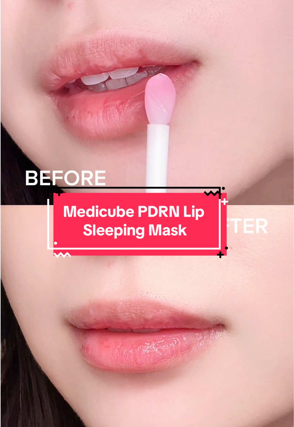 It’s not a candy 🍭 It’s the NEW Medicube PDRN Lip Sleeping Mask 💗