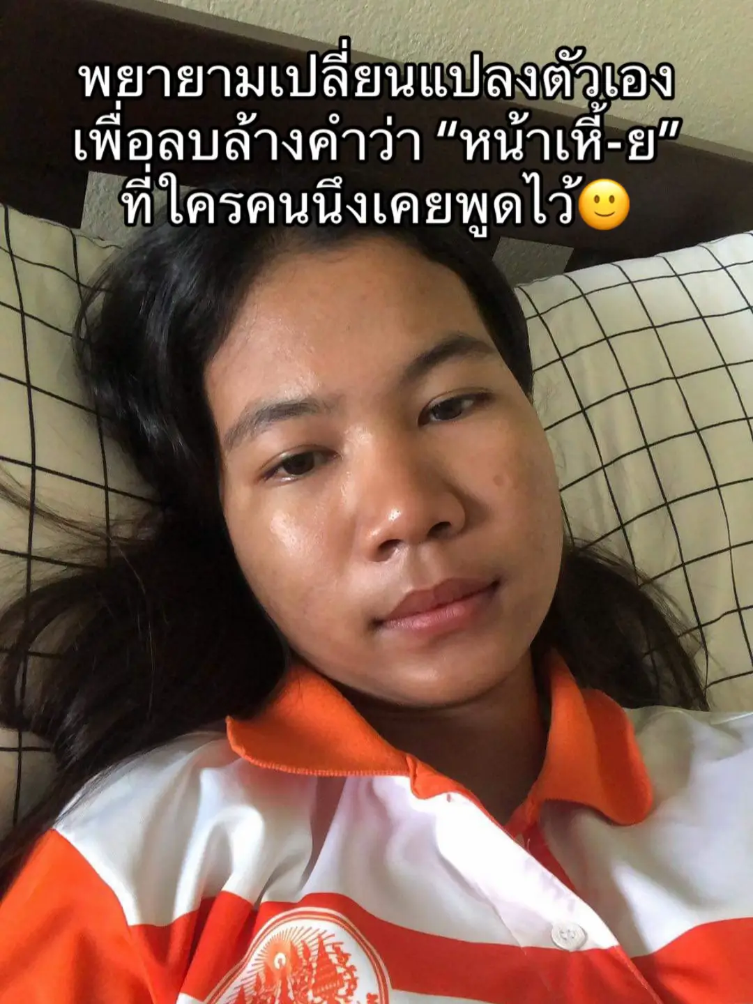 #ศัลยกรรม #เปลี่ยนแปลงตัวเอง #ศัลยกรรมเปลี่ยนชีวิต #fyppppppppppppppppppppppp #ฟีดดดシ 