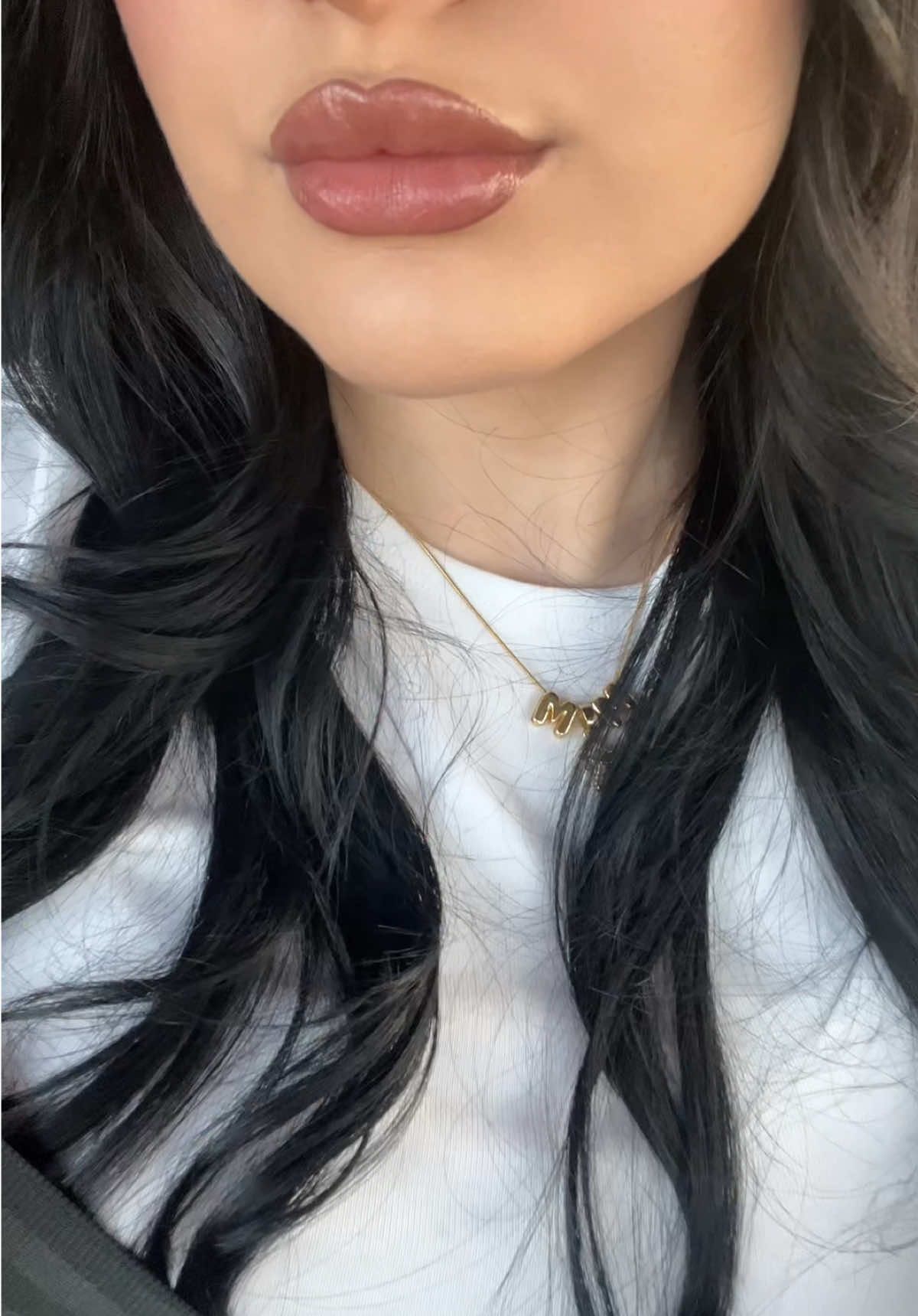 TW: injections | 0.5 for a little plump nothing crazy since my lips are already a good size! pain level 1/10 🍓💉🫦😍  @Remake Beauty Studio  #filler #rgv #lips #956 #SelfCare 