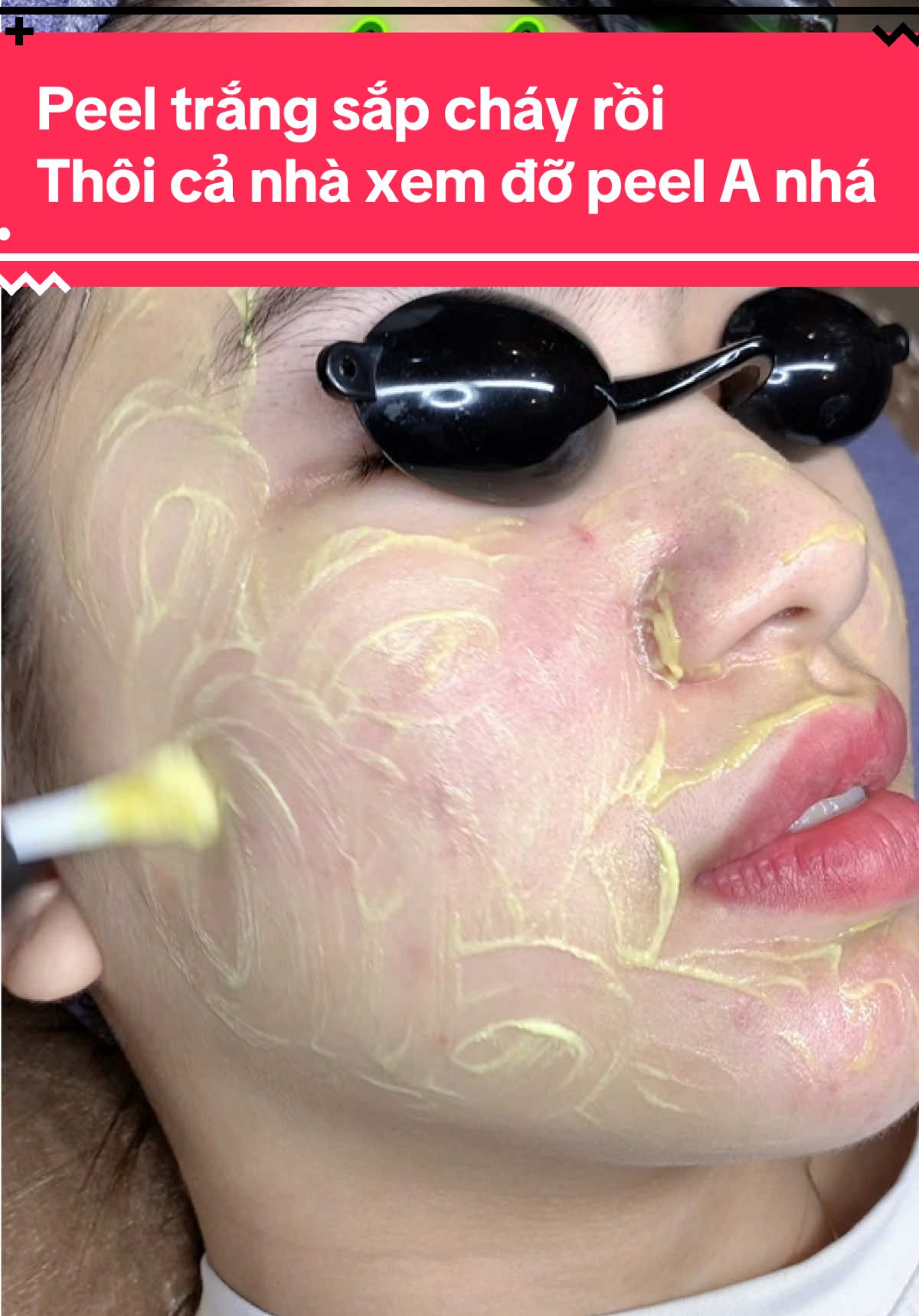 Peel trắng sắp cháy rồi Thôi cả nhà xem đỡ peel A nhá#túdoli #mixpeel #trắngda #ủtrang #peeltrắng 
