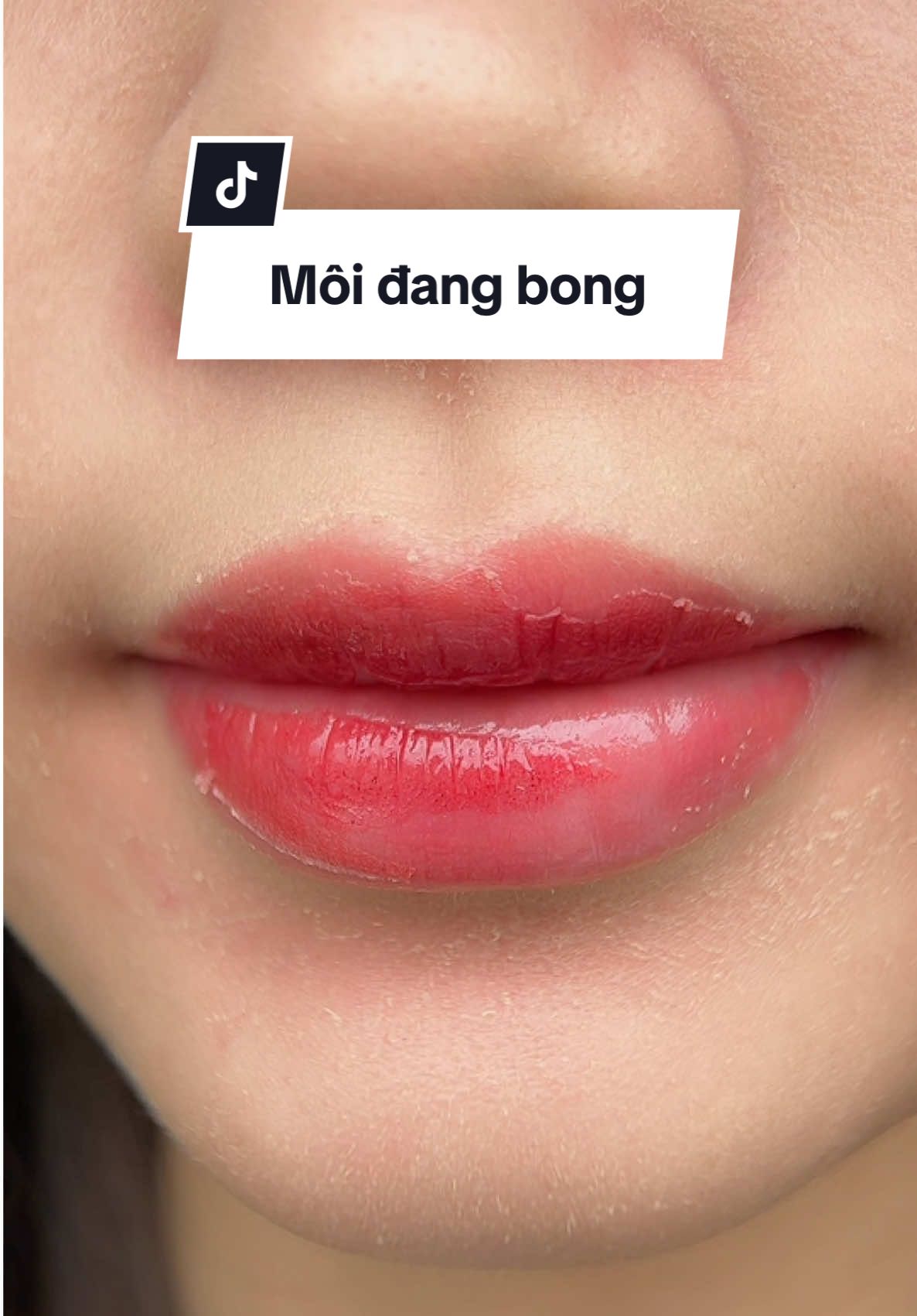 Môi đang bong nha quý vị : nhiều chỗ vẫn chưa đều màu vì da mới bong còn non nên 2 tháng sẽ ổn định nhé. Gu dành cho bạn nào thích nhẹ nhàng tự nhiên trong trẻo 😍#tưởngKhánhLinh #linhligg #phunmoideptaihanoi #phunmoi #phunmoidep 