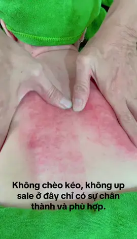 #trịlieucovaigay #trịlieulungeo #gôidauduongsinh 