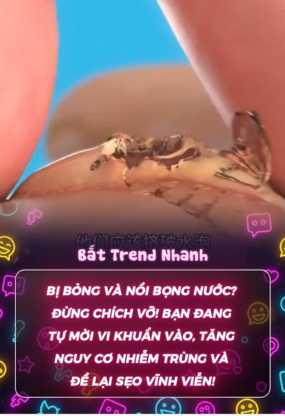 #bongda #fyppppppppppppppppppppppp #xuhuong #viral 