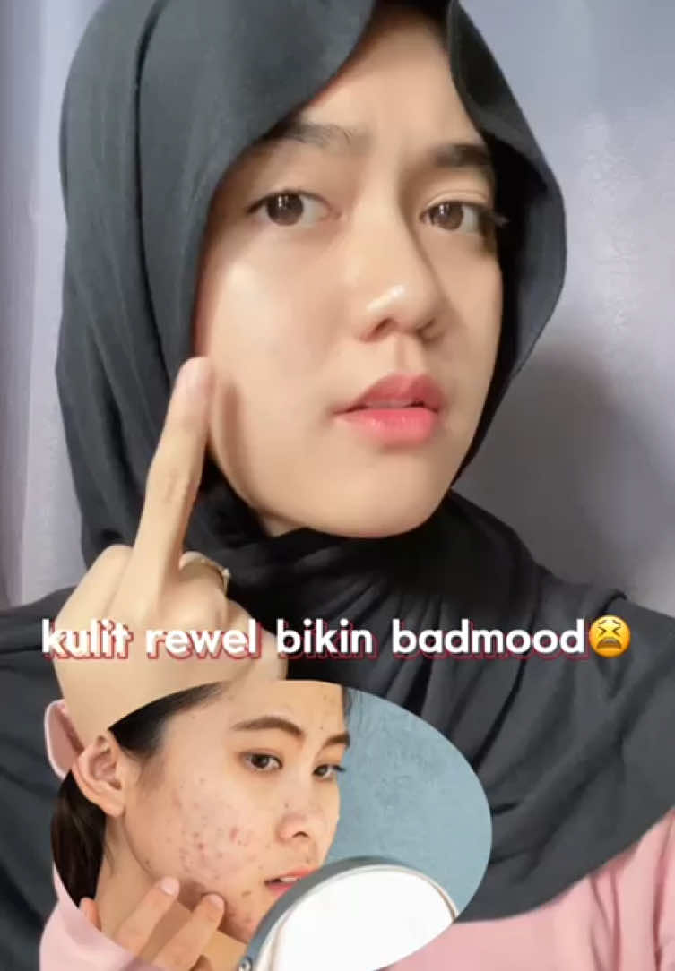 kulit lagi rewel auto pake moist penyelamat andalan aku dari pipiqiu🫶🏻✨ #Pipiqiumoisturizer #PipiqiuBeauty #Cinnamoroll #skincarelokal #panthenol