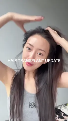 Replying to @user73317088758 buat rambut skrg padat dan tebel say #hairgrowth #alternativeminoxidil