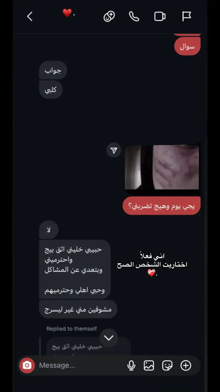 الحمدلله اختاريت الشخص الصح لان بنضري الميحب اهله وميحترهم هذا مراح يحبني ولا راح يصوني ولا اشوف منه ذرة حنان فَـ الف الحمدلله من انطاني انسان يخاف الله باهله وبيه لان هاي نعمه من نعم الله عليه الحمد والشكر لله ونعم الله كثير من ضمهن عائلته الـჂ̤ احسبهم عائلتي الثانيه وبيتي …. 📍وبنهايه ﭑنـჂ ڪُـلش اهواي آحـبُه واحب اهله وهمه الحمدلله يحبوني ومشفت منهم غير كل خير ❤️‍🩹. 📌خلاصة الكلام هذا انو من تختارون اختارو الاشخاص الـჂ̤ يحبون اهلهم لان بهذا الوكت اهواي دنشوف اشخاص يحجون ع اهلهم ويتعبوهم فَـ خلو ابالكم هل كلام الما بي خير الاهله مبي خير الكم 👍🏼❤️‍🩹. #اكسبلور #fyp #كلام_من_القلب #مالي_خلق_احط_هاشتاقات 