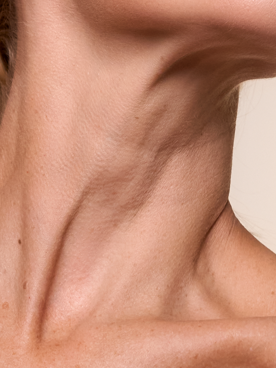 ¿Te preocupan las arrugas del cuello y del escote? Apunta estos tips de @dra.annapuigdollers para tratarlas y prevenirlas. #arrugas #arrugascuello #skincare #antiedad #antienvejecimientofacial