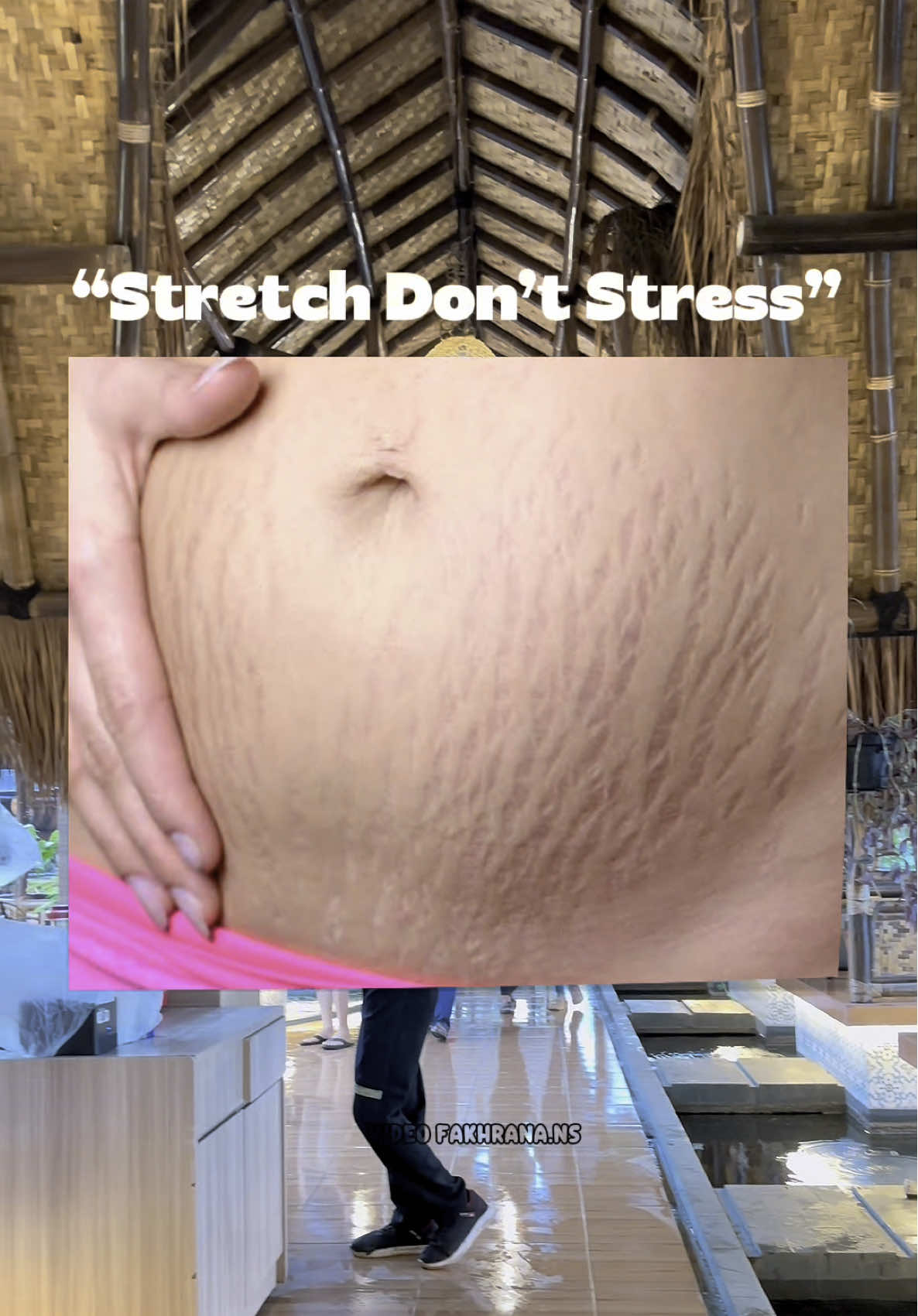 Jgn lg stress gara2 stretchmark karena aku punya solusinya dr produk Ciara😍👍🏽 #stretchmark #stretchmarks #stretchmarkserum #stretchmarkoil #ciaraindonesia #CapCut 