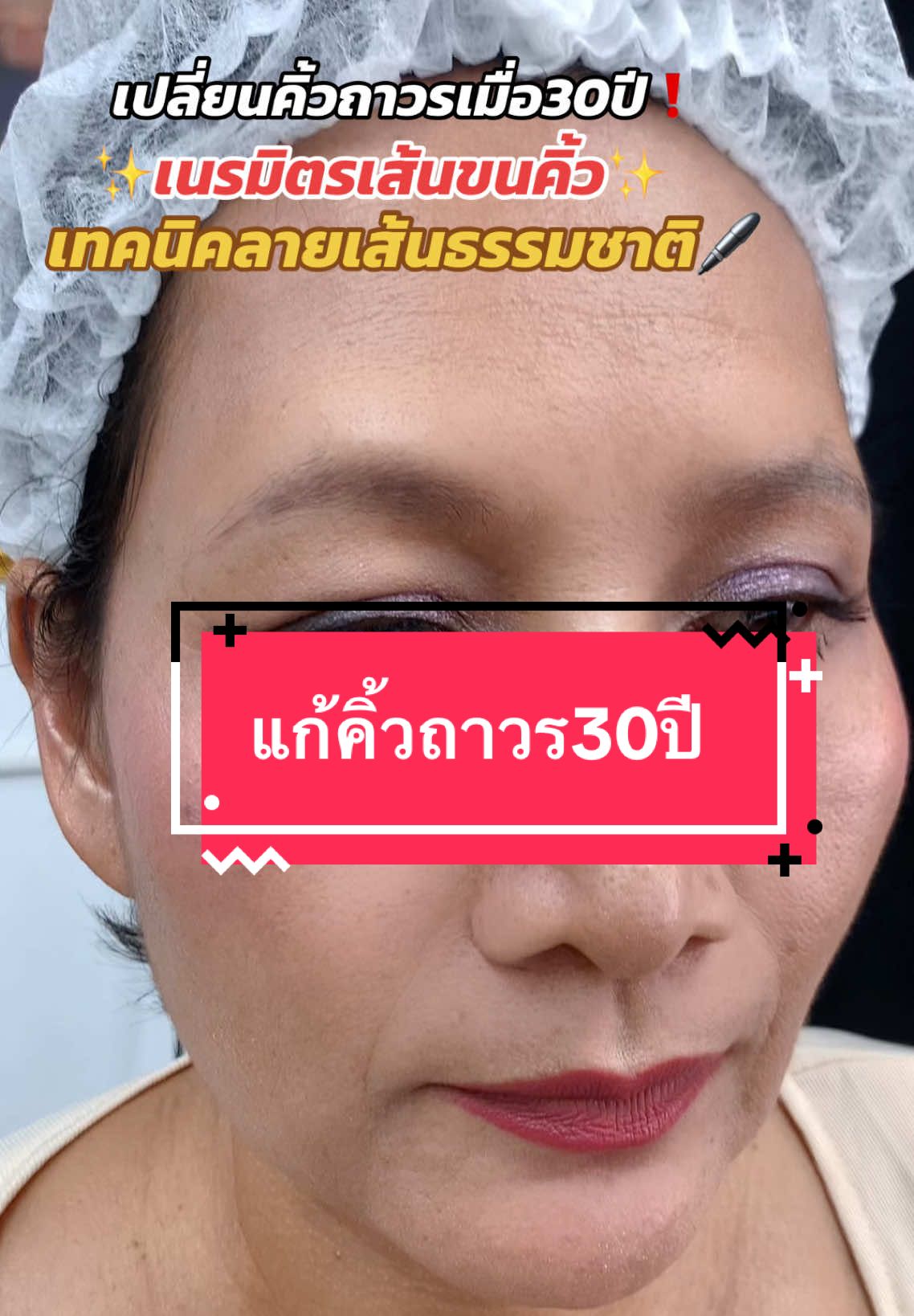 รีโนเวทคิ้วถาวรเดิม30ปี ด้วยเทคนิคยอดฮิต Superhairstroke premium ลายเส้นธรรมชาติ #สักคิ้วเชียงราย #แก้คิ้วเชียงราย #อาจารย์เต๋าสักคิ้วเชียงราย #สักแก้คิ้วถาวร #กู้คิ้วพังเชียงราย 