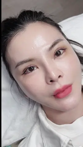 Mắt 5 ngày cắt chỉ bên em . Xinh không cả nhà ơi . Đây là ca hạ size hôm trước e đăng đó #bắcninh #cắtmí #kcnvsipbắcninh #cắt_mí_tự_nhiên #sửamílỗihỏng 