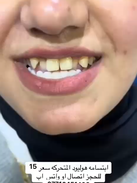 للحجز واتس اب 07716451498