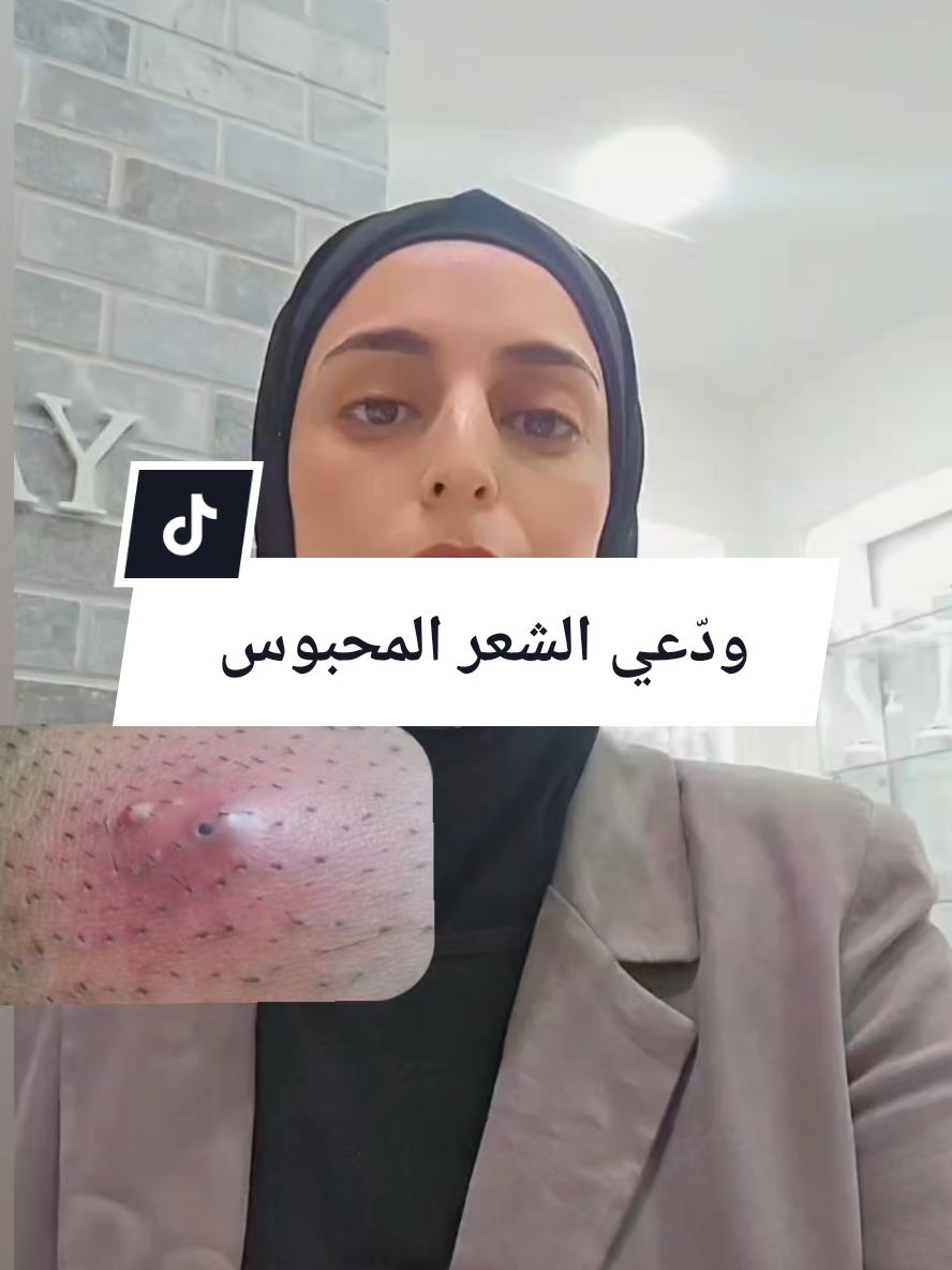 #شعر_محبوس #وداعاً_للشعر_المنغرز #بشرة_ناعمة #جسم_حرير #مراكز_يافا 