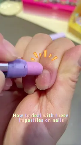 This is a pen that can take care of nails #nails #nailcare #nailglowup #musthave #tiktok 