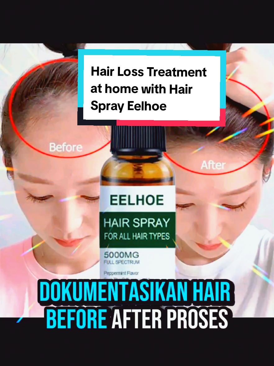 Setiap nyisir rambut rontok terus... Sekarang sudah engak lagi.Rahasianya?Hair loss treatment at home dengan Eelhoe Hair Spray tiap hari lihat bedanya. #haircare #hairtreatment #modalkontendoang #sipalingaffiliate  #creatorsearchinsights 