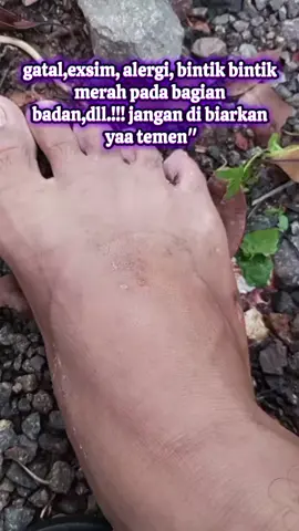 buruan ambil promonya #salepracikan #salepgatal #salep #fyp 