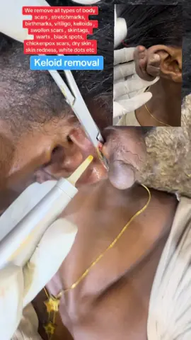 #kampala_uganda🇺🇬🇺🇬🤝 #kampala_tiktokers #trendingvideo #fatdissolving 